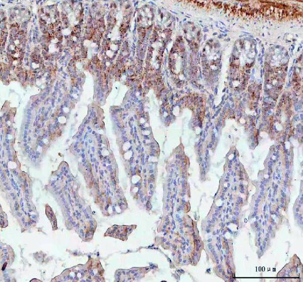 BCMA Antibody in Immunohistochemistry (Paraffin) (IHC (P))