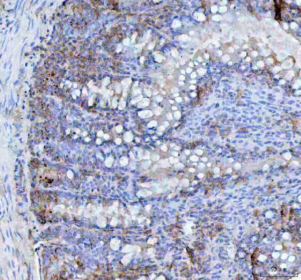 BCMA Antibody in Immunohistochemistry (Paraffin) (IHC (P))