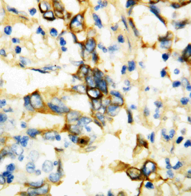 TNFR1 Antibody in Immunohistochemistry (Paraffin) (IHC (P))