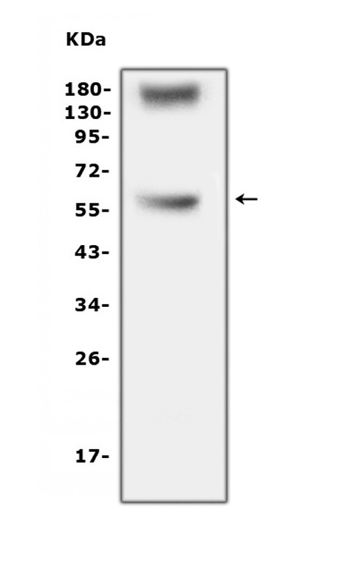 TNFR1 Antibody in Western Blot (WB)