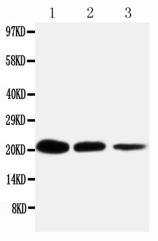 TNFR1 Antibody in Western Blot (WB)