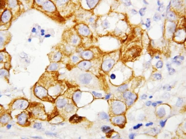 TNFR2 Antibody in Immunohistochemistry (Paraffin) (IHC (P))