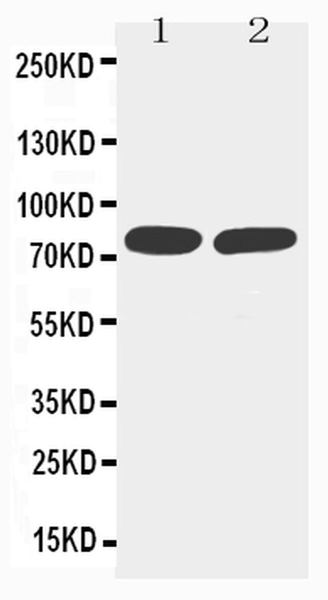 TNFR2 Antibody in Western Blot (WB)