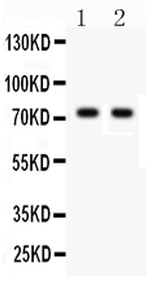 TNFR2 Antibody in Western Blot (WB)