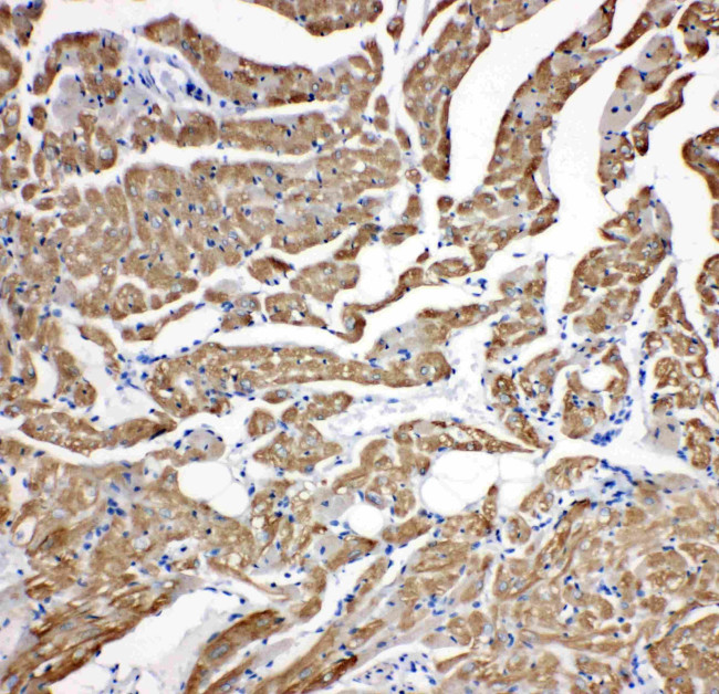 Cardiac Troponin C Antibody in Immunohistochemistry (Paraffin) (IHC (P))