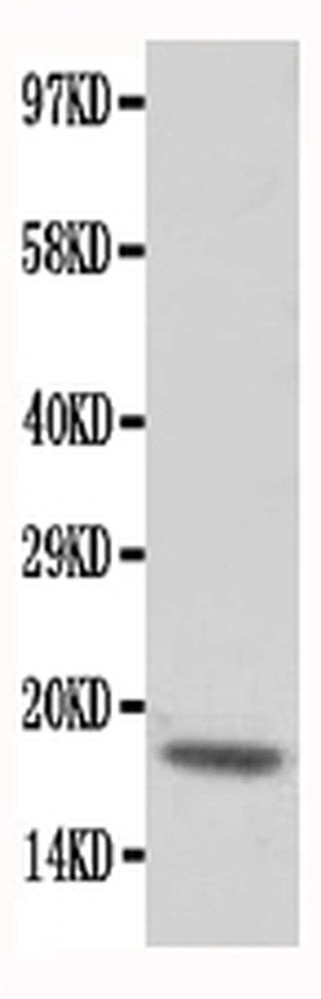 Cardiac Troponin C Antibody in Western Blot (WB)