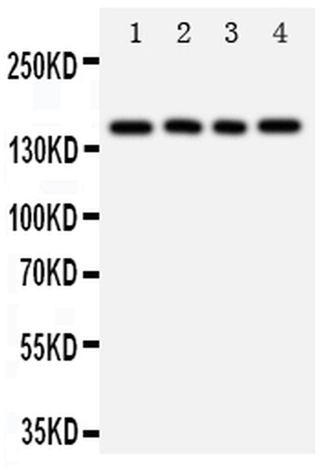 Tenascin R Antibody in Western Blot (WB)