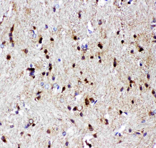 p73 Antibody in Immunohistochemistry (Paraffin) (IHC (P))