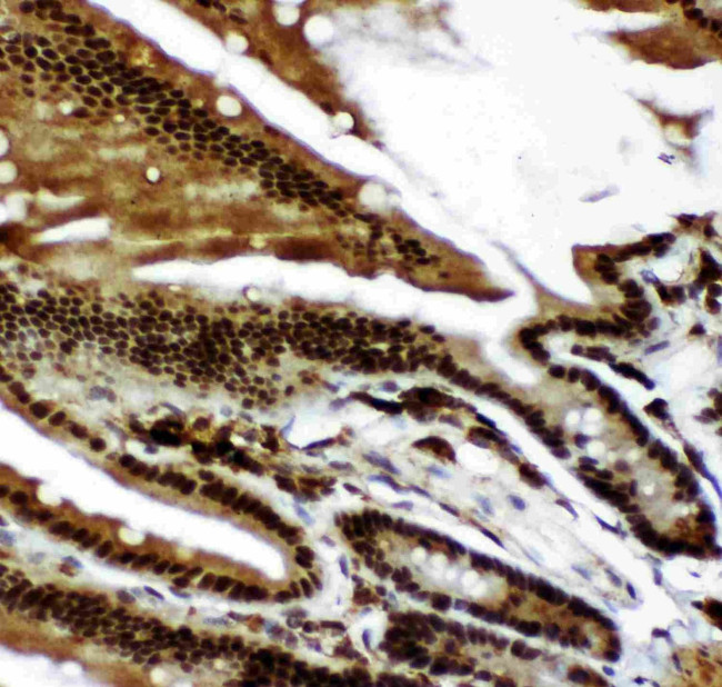 p73 Antibody in Immunohistochemistry (Paraffin) (IHC (P))