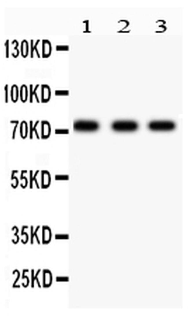 p73 Antibody in Western Blot (WB)