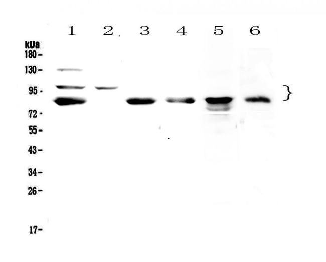 TPX2 Antibody in Western Blot (WB)