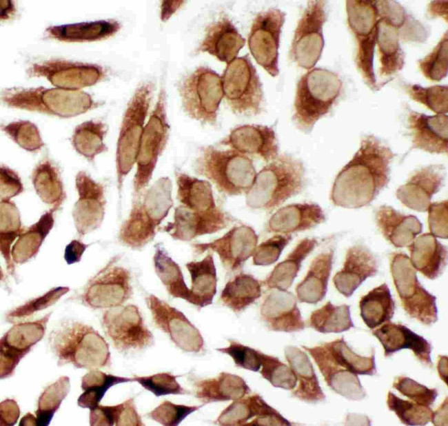 TRAM1 Antibody in Immunocytochemistry (ICC/IF)