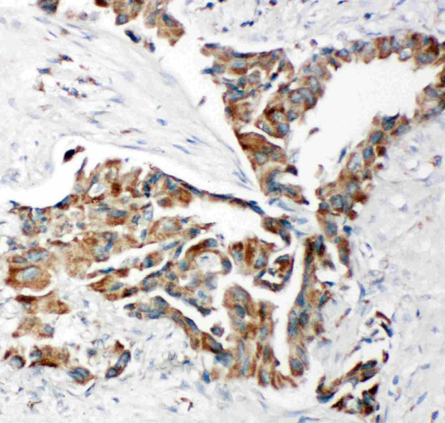 TRAM1 Antibody in Immunohistochemistry (Paraffin) (IHC (P))