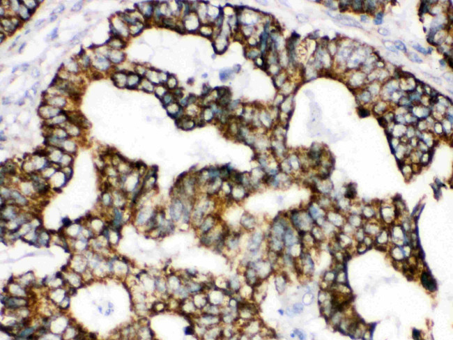 TRAP1 Antibody in Immunohistochemistry (Paraffin) (IHC (P))