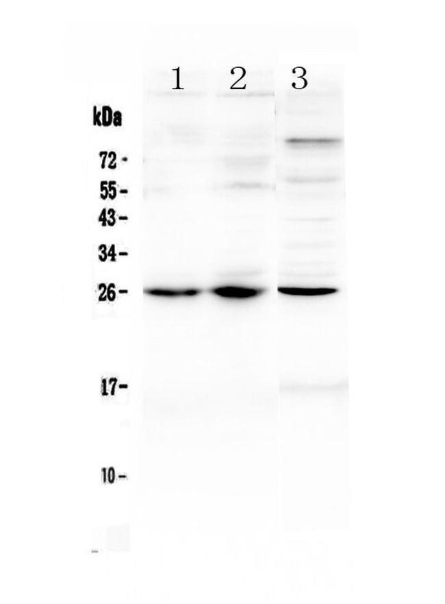 TREM1 Antibody in Western Blot (WB)