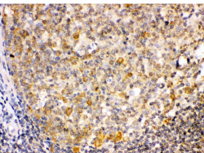 TRIB2 Antibody in Immunohistochemistry (Paraffin) (IHC (P))