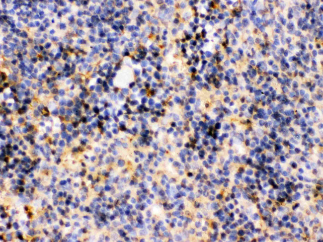 TRIB2 Antibody in Immunohistochemistry (Paraffin) (IHC (P))