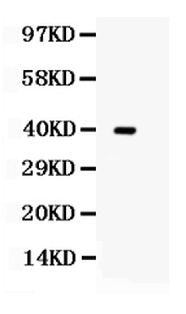 TRIB2 Antibody in Western Blot (WB)