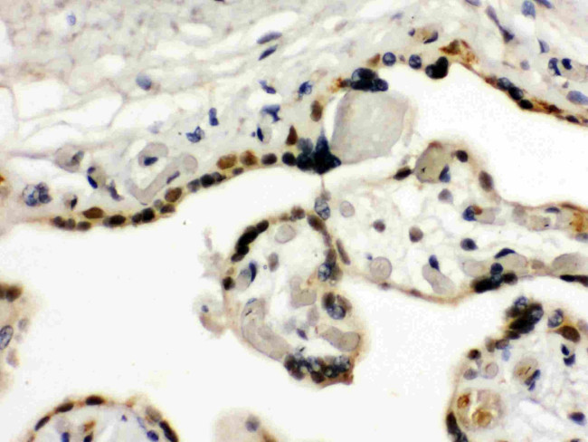 TIF1 gamma Antibody in Immunohistochemistry (Paraffin) (IHC (P))