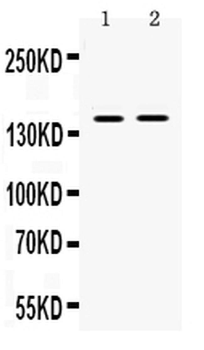 TIF1 gamma Antibody in Western Blot (WB)