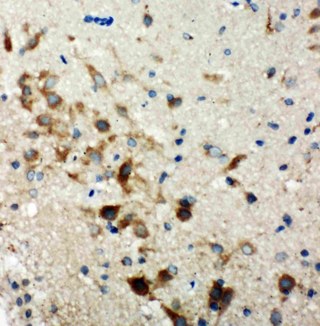 TSC1 Antibody in Immunohistochemistry (Paraffin) (IHC (P))