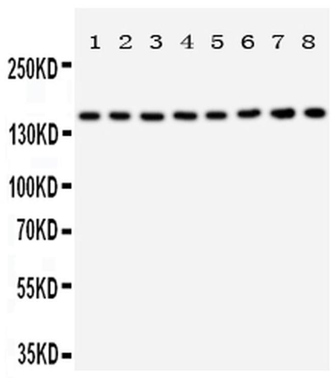 TSC1 Antibody in Western Blot (WB)