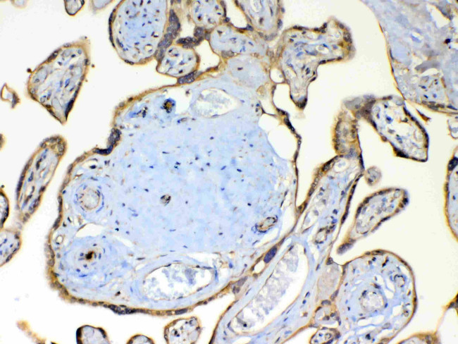 TSPAN12 Antibody in Immunohistochemistry (Paraffin) (IHC (P))