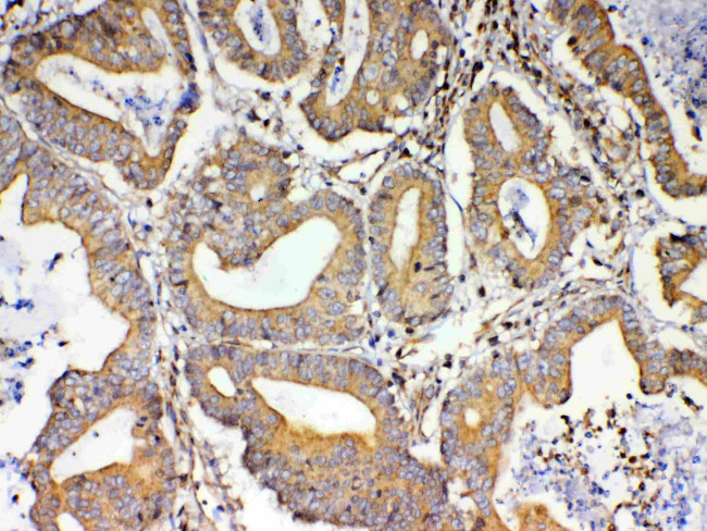 TSPAN12 Antibody in Immunohistochemistry (Paraffin) (IHC (P))