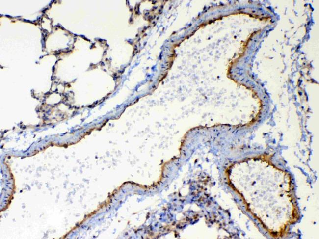 TSPAN12 Antibody in Immunohistochemistry (Paraffin) (IHC (P))