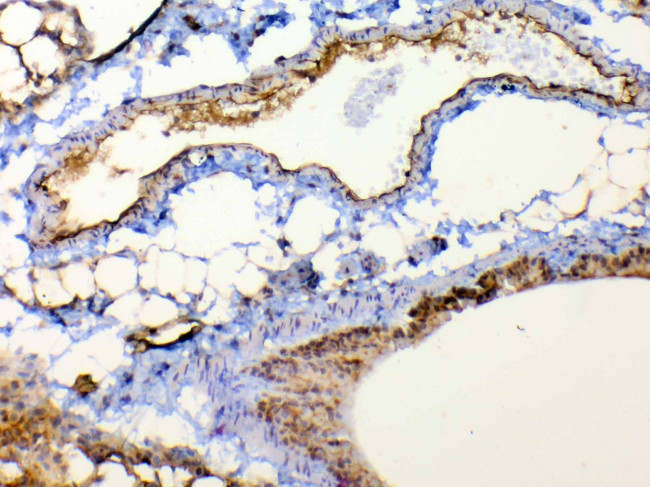 TSPAN12 Antibody in Immunohistochemistry (Paraffin) (IHC (P))