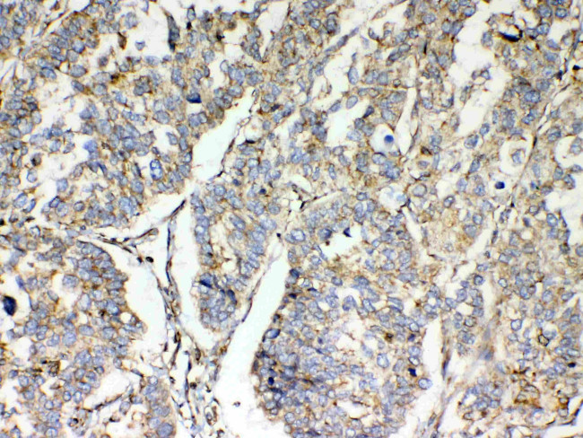 TSPAN12 Antibody in Immunohistochemistry (Paraffin) (IHC (P))