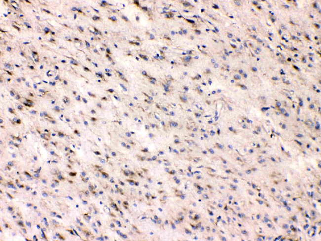 Beta III Tubulin Antibody in Immunohistochemistry (Paraffin) (IHC (P))