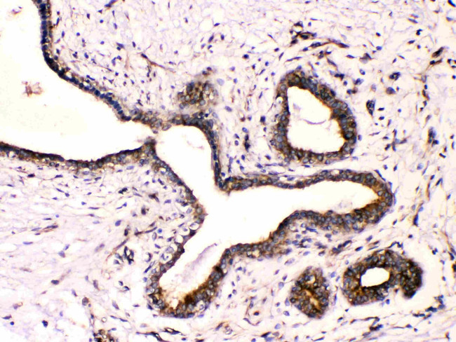 Beta III Tubulin Antibody in Immunohistochemistry (Paraffin) (IHC (P))