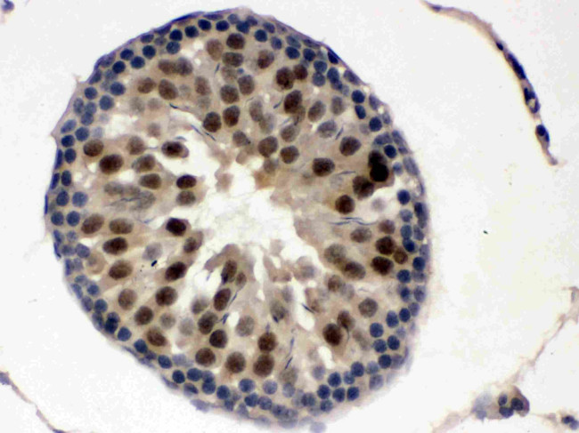 UBA3 Antibody in Immunohistochemistry (Paraffin) (IHC (P))