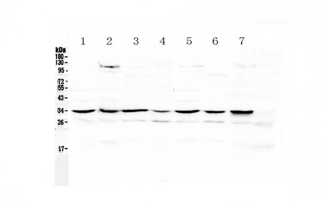 UCP2 Antibody in Western Blot (WB)