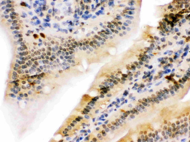 UHRF2 Antibody in Immunohistochemistry (Paraffin) (IHC (P))