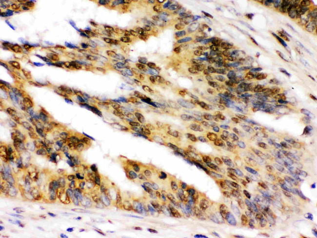 UHRF2 Antibody in Immunohistochemistry (Paraffin) (IHC (P))