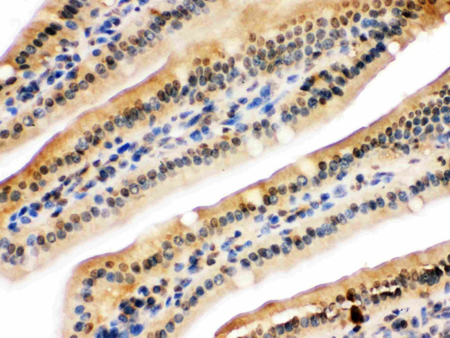 UHRF2 Antibody in Immunohistochemistry (Paraffin) (IHC (P))