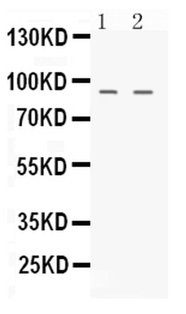 UHRF2 Antibody in Western Blot (WB)