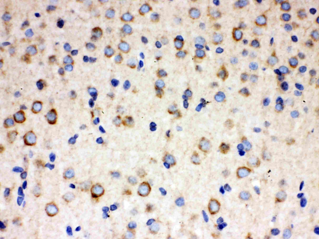 ULK3 Antibody in Immunohistochemistry (Paraffin) (IHC (P))