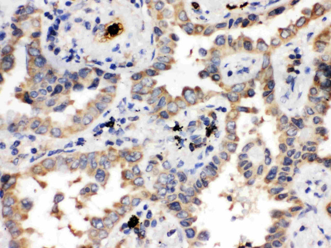 ULK3 Antibody in Immunohistochemistry (Paraffin) (IHC (P))