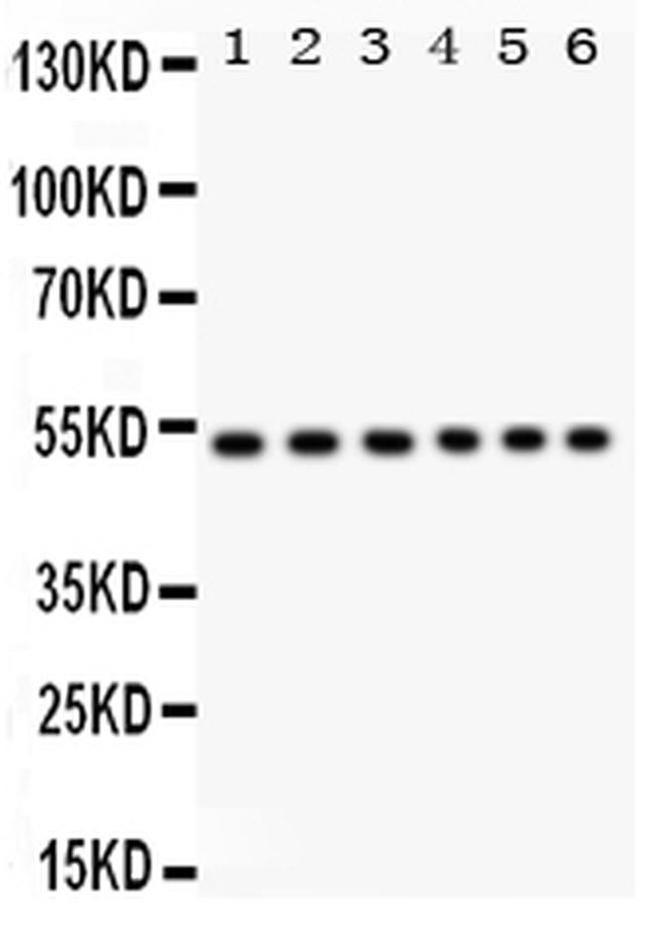 ULK3 Antibody in Western Blot (WB)