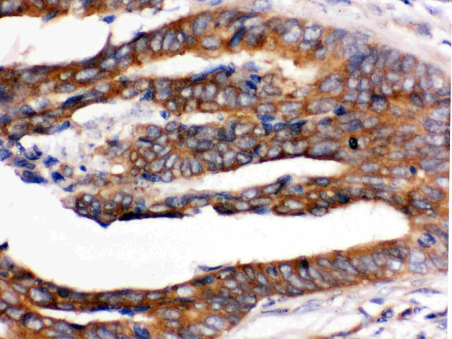 UPF1 Antibody in Immunohistochemistry (Paraffin) (IHC (P))