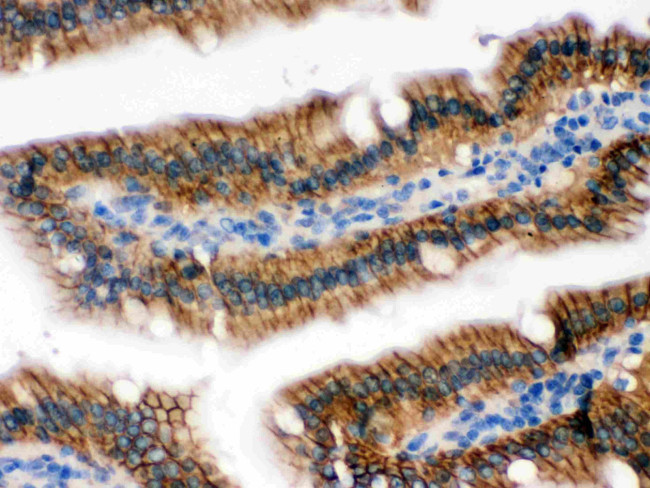 UPF1 Antibody in Immunohistochemistry (Paraffin) (IHC (P))