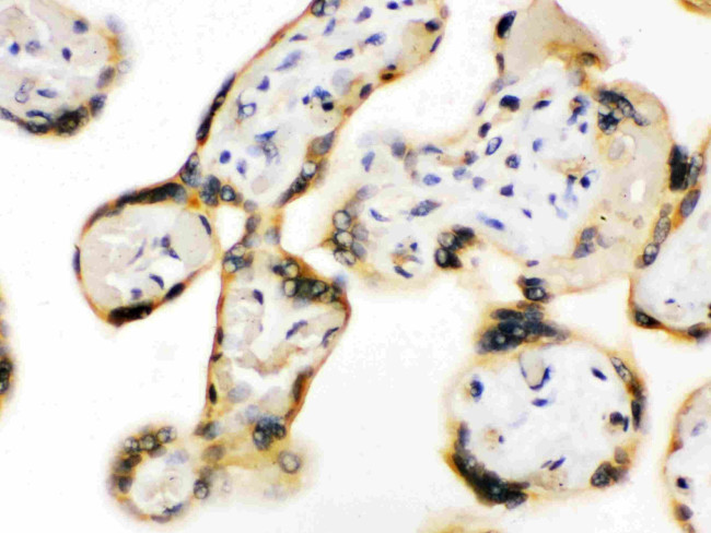 UPF3B Antibody in Immunohistochemistry (Paraffin) (IHC (P))