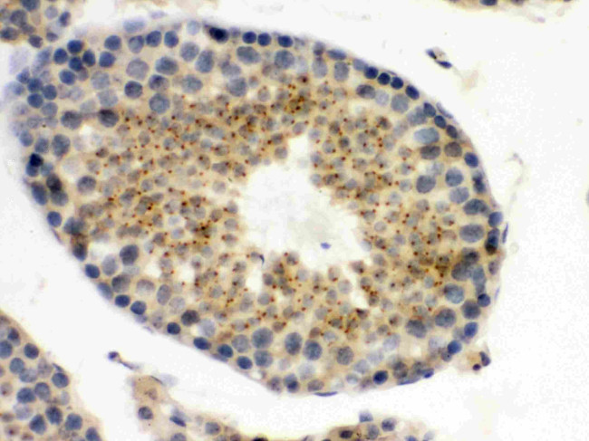 UPF3B Antibody in Immunohistochemistry (Paraffin) (IHC (P))