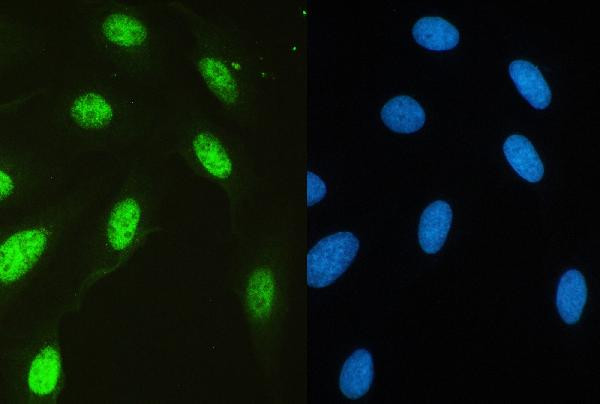 USP7 Antibody in Immunocytochemistry (ICC/IF)