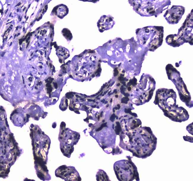 USP7 Antibody in Immunohistochemistry (Paraffin) (IHC (P))