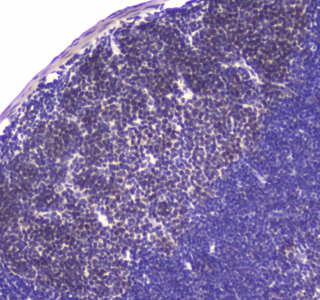 USP7 Antibody in Immunohistochemistry (Paraffin) (IHC (P))