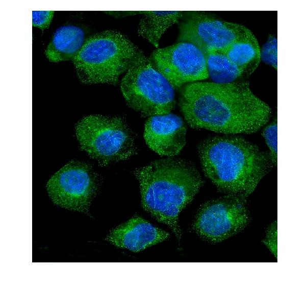 VAPB Antibody in Immunocytochemistry (ICC/IF)